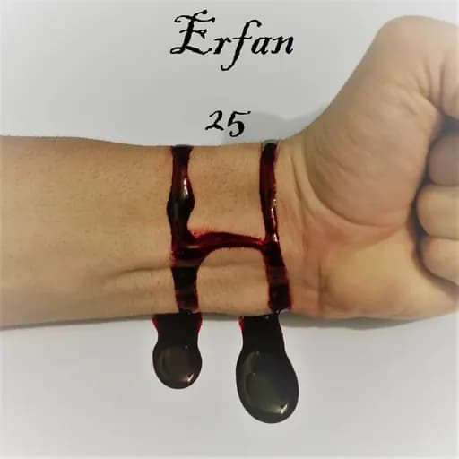 25